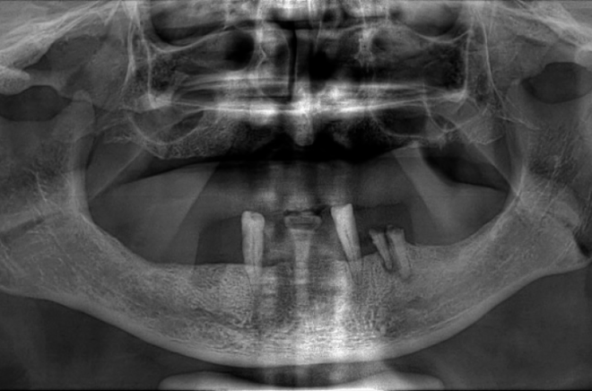 Sistema Di Posizionamento A 3 Assi - SpotOn - Duma Optronics - Ottico - Foto 9